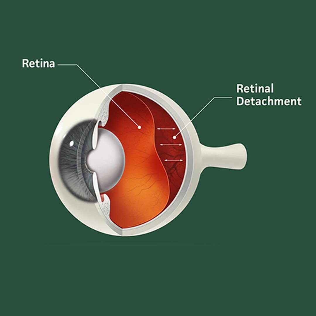 Retina Services